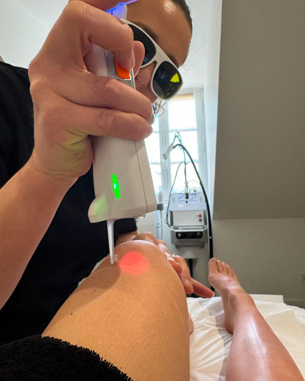 Laser-epilatoire Séance laser épilatoire